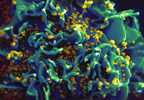 Good News Now, and Maybe Later, for HIV Patients