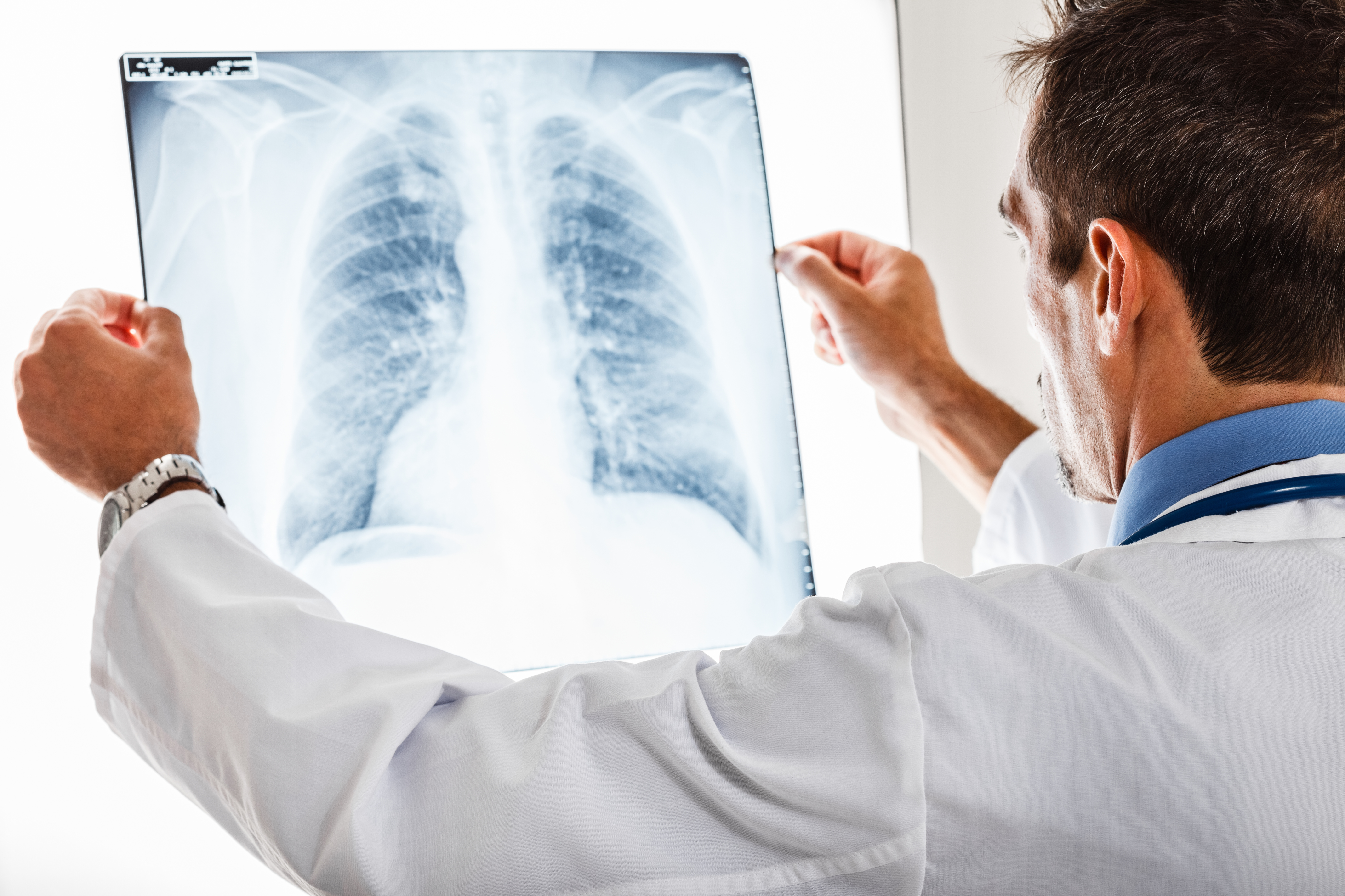 Omicron Replicates Slower In Lungs, Faster In Airways Of COVID-19 Patients: Study