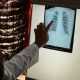 How The COVID-19 Pandemic Affected TB Cases In The US