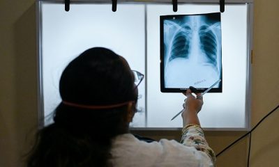 Washington Records ‘Largest’ TB Outbreak In 20 Years