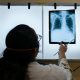 Washington Records ‘Largest’ TB Outbreak In 20 Years