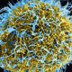 Mysterious Hepatitis Outbreak Claims 11 Lives; 450 Cases Reported Worldwide