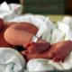 'Miracle' Baby Born With 4 Legs, 4 Arms; Now Has Religious Following