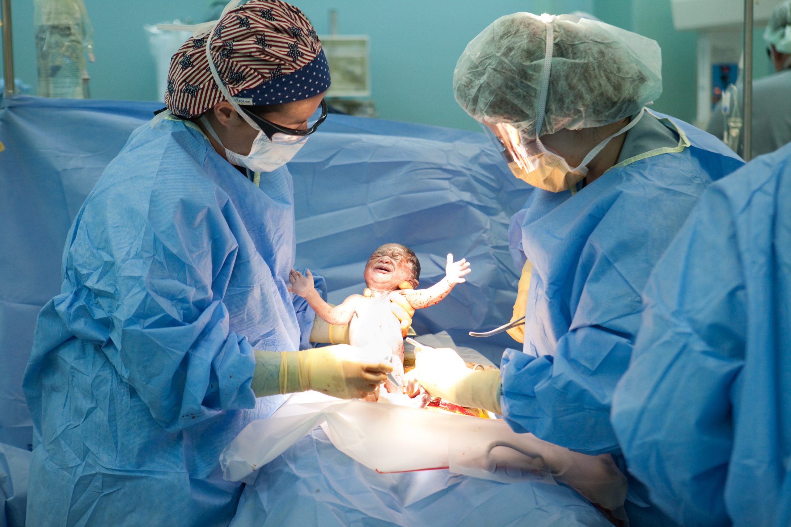 C-Section Linked To A Higher Risk Of Cardiovascular Diseases, Obesity In Children