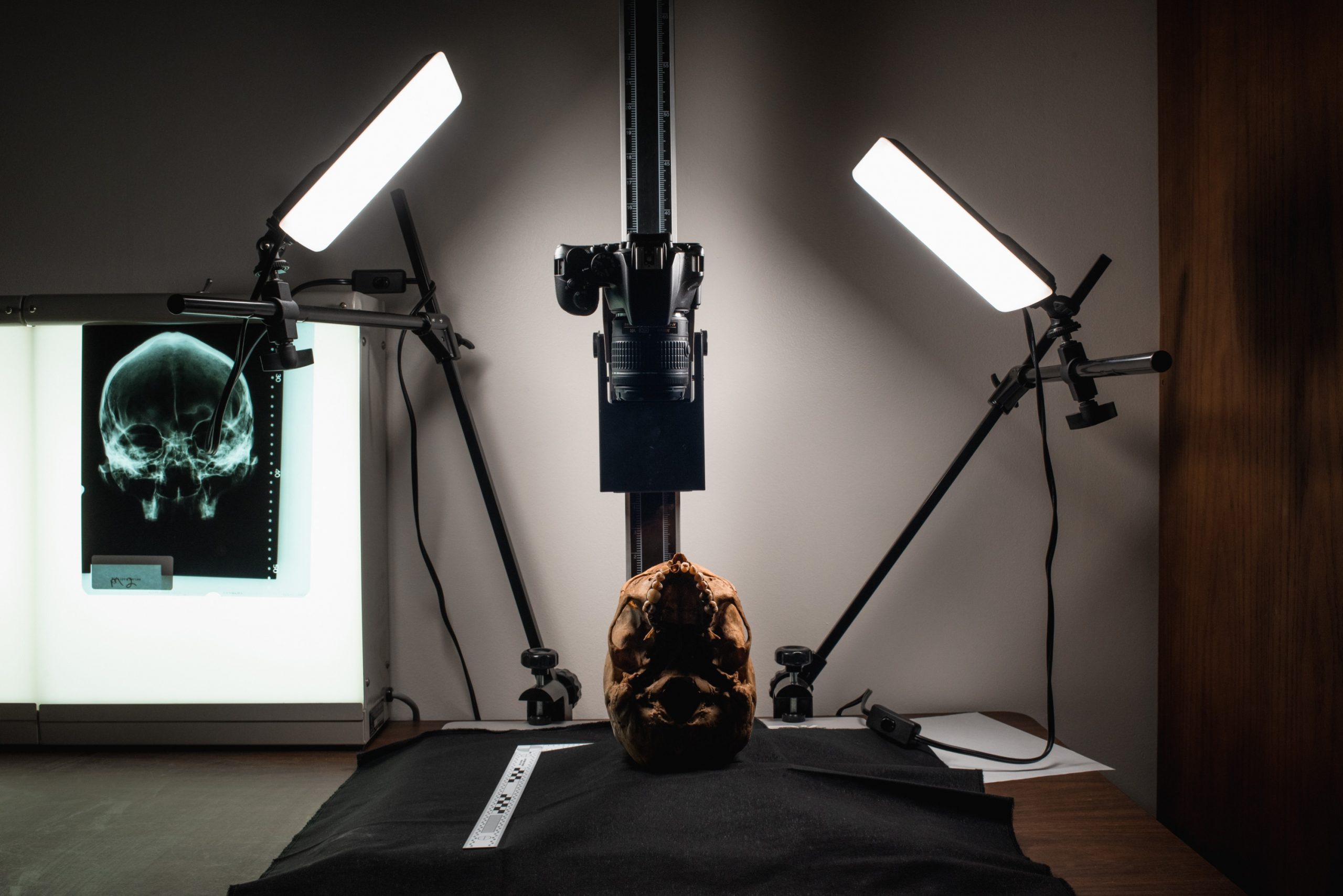 human remains on a copy stand to be photographed