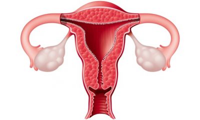 'Game Changer': Scientists Map Cellular Changes Associated With Endometriosis