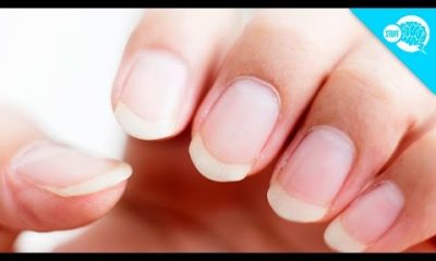 Manicure May Have Given Woman Cancer: 'It Hurt A Lot'