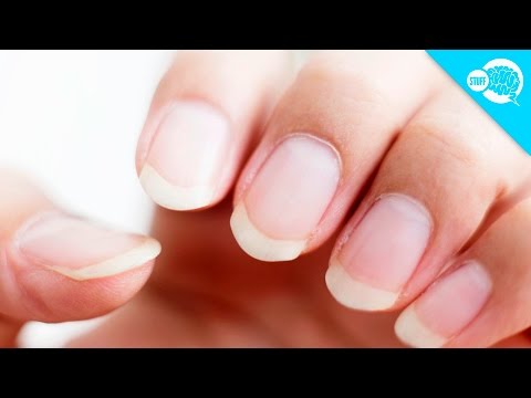 Manicure May Have Given Woman Cancer: 'It Hurt A Lot'