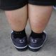 Obesity In Children Linked To Higher Risk Of 4 New Subtypes Of Adult-Onset Diabetes