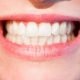 Oil Pulling: Does The Dental Practice Have Any Real Benefits?