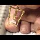 This Weird New Japanese Contraption That Fixes Ingrown Toenails Is Gross But Satisfying