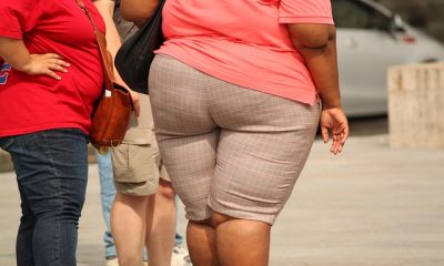 Link Between Obesity And COVID-19 May Be Explained By Underactive Immune Response: Study