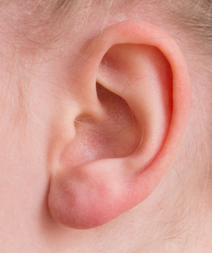 Sharp ear pain can happen due to